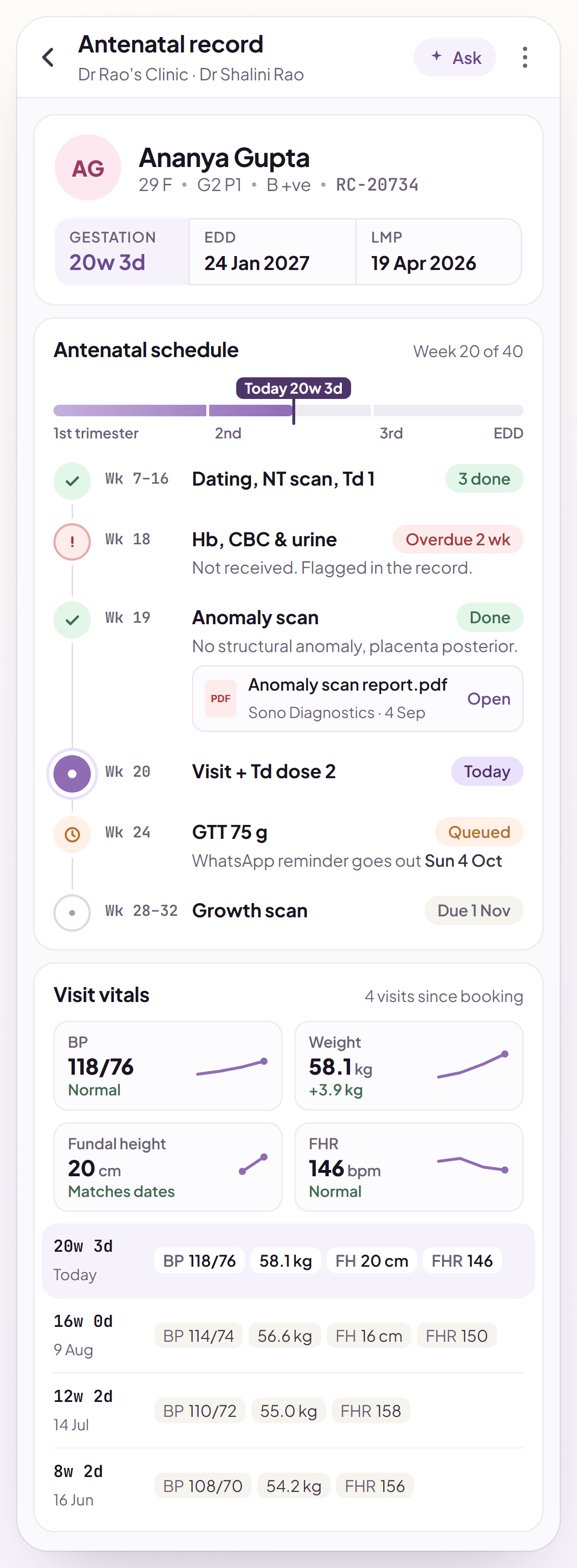 Saaro antenatal record at 20 weeks 3 days, built from the LMP: a gestational-week timeline with dating scan, NT scan and first Td dose done, Hb and urine tests flagged overdue, the anomaly scan report attached to its milestone, today's visit, the GTT reminder queued for week 24 and the growth scan next, plus BP, weight, fundal height and foetal heart rate recorded at each visit with trends